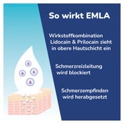 Emla Creme 5X5 g