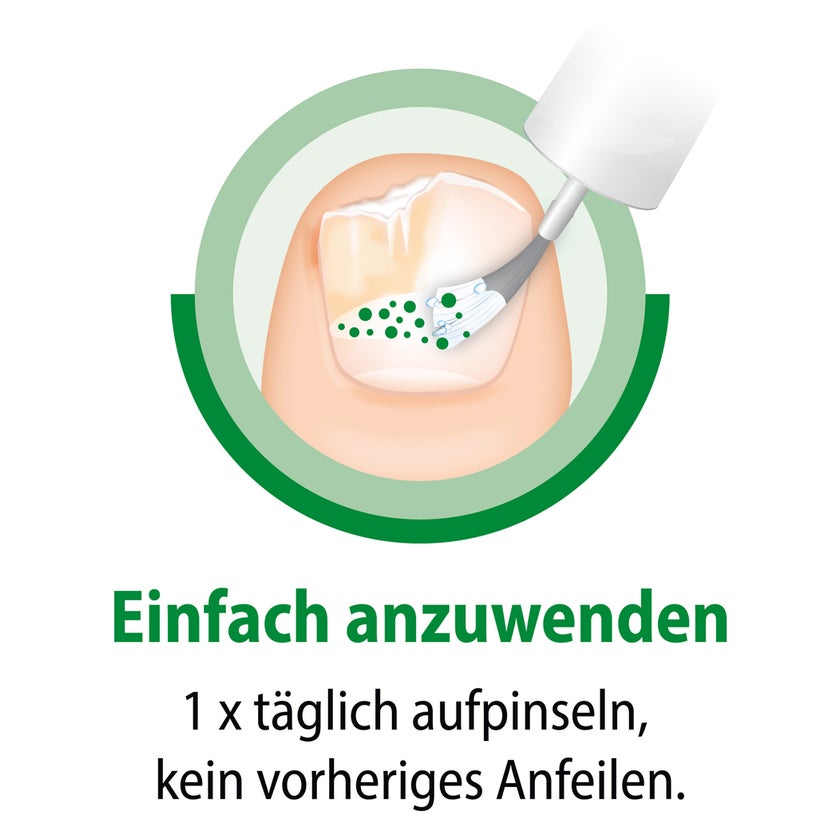 Ciclopoli gegen Nagelpilz 6,6 ml