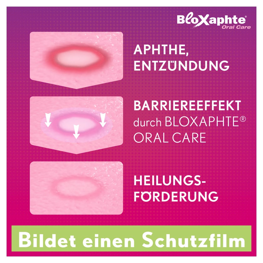 Bloxaphte Oral Care Mundgel 15 ml