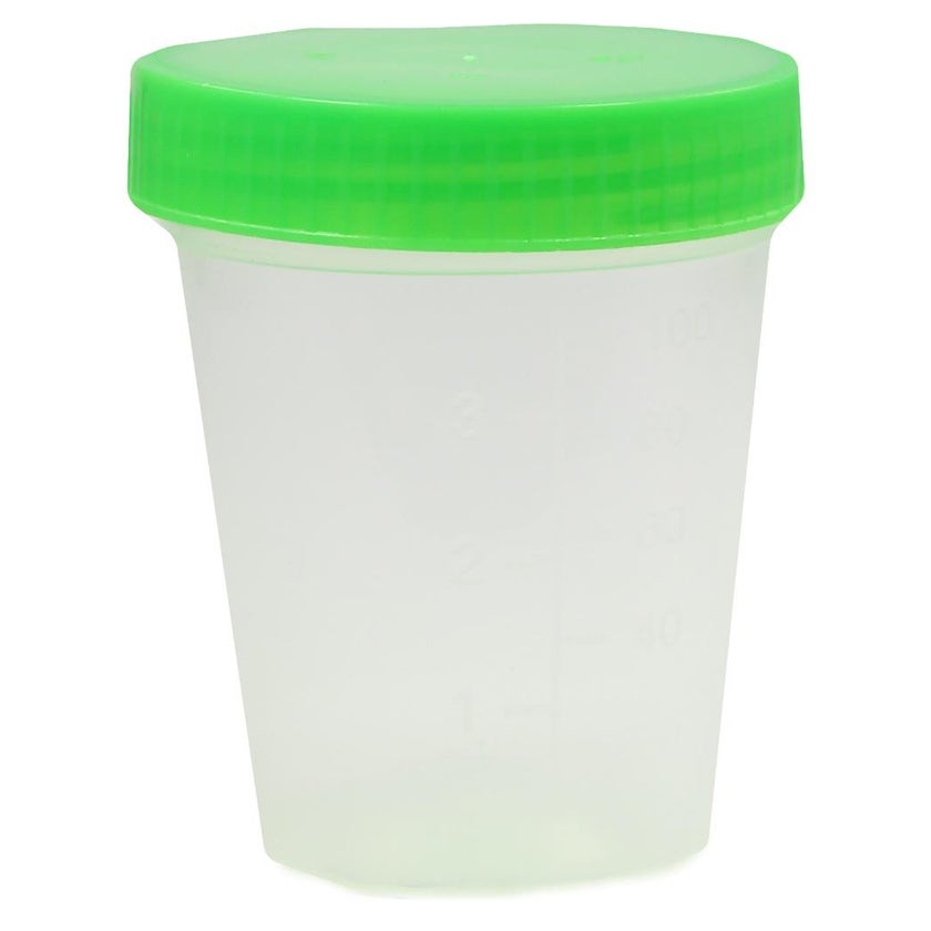 Urinbecher mit Schraubdeckel einzelverpa 1 St